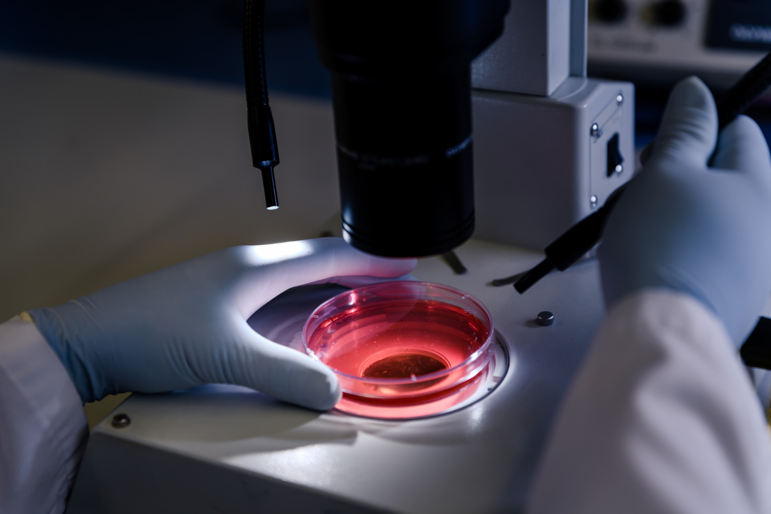 Leukocyte Esterase in Urine Explained
