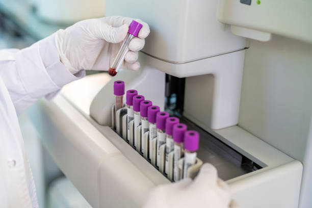 SPF In Vitro Screening